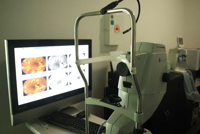 Atención para ojo rojo en Querétaro