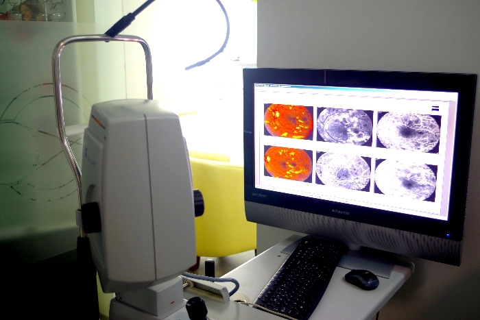 Catarata y glaucoma en Querétaro